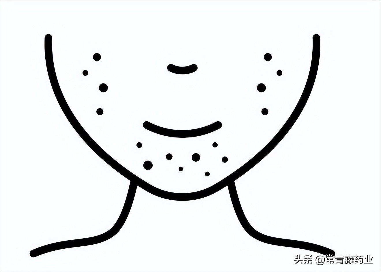 口周湿疹与口周皮炎的症状区别,口周皮炎是对称的吗