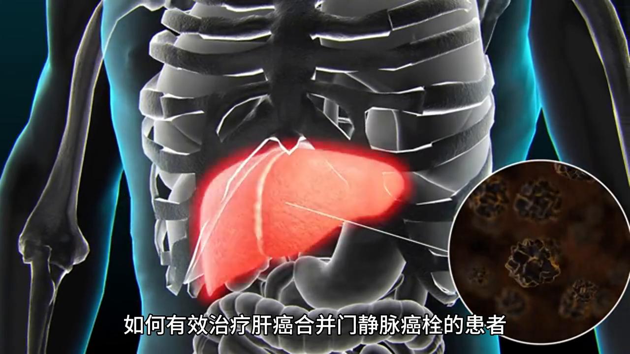 介入和消融治疗肝癌的优点和缺点,纳米消融技术治肝癌在什么医院有