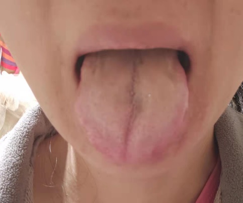 5个淡斑秘籍,淡斑最简单有效的方法白糖