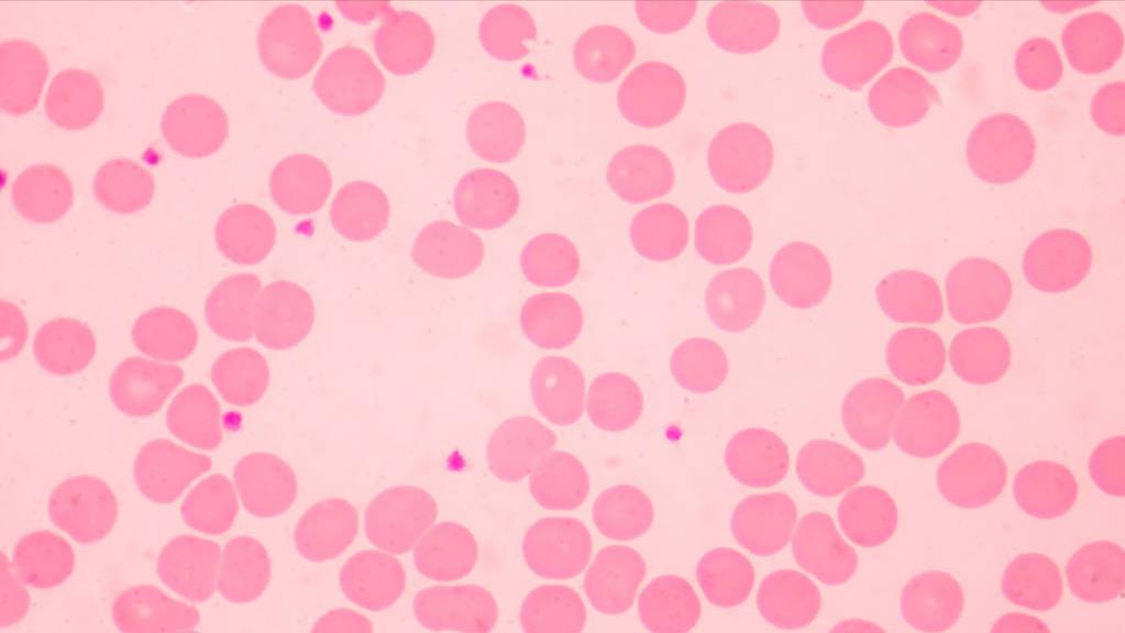 血管外科刁永鹏主任,北京医院血管外科刁永鹏