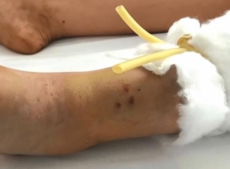 女子网购毒蛇被咬身亡，母亲追责索赔百万，买它究竟干什么用？