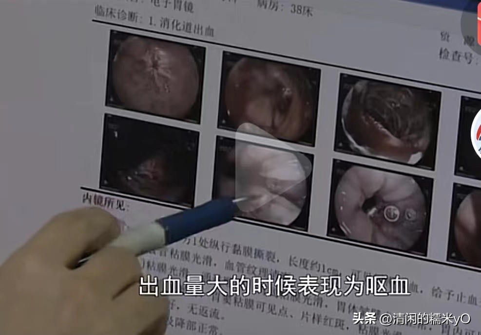 男子一口闷冰镇红茶后狂吐,男子喝冰红茶狂吐1000