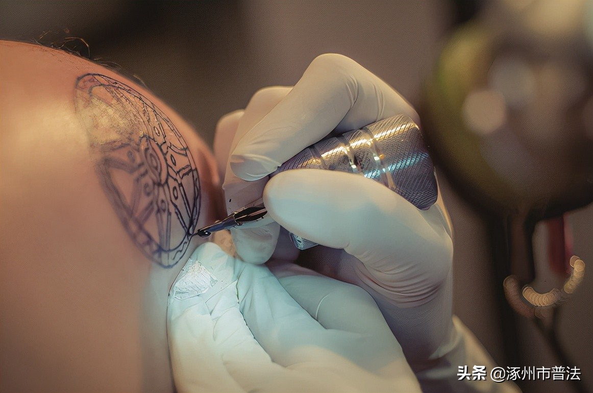 女孩用硫酸洗纹身,硫酸洗纹身后皮肤溃烂