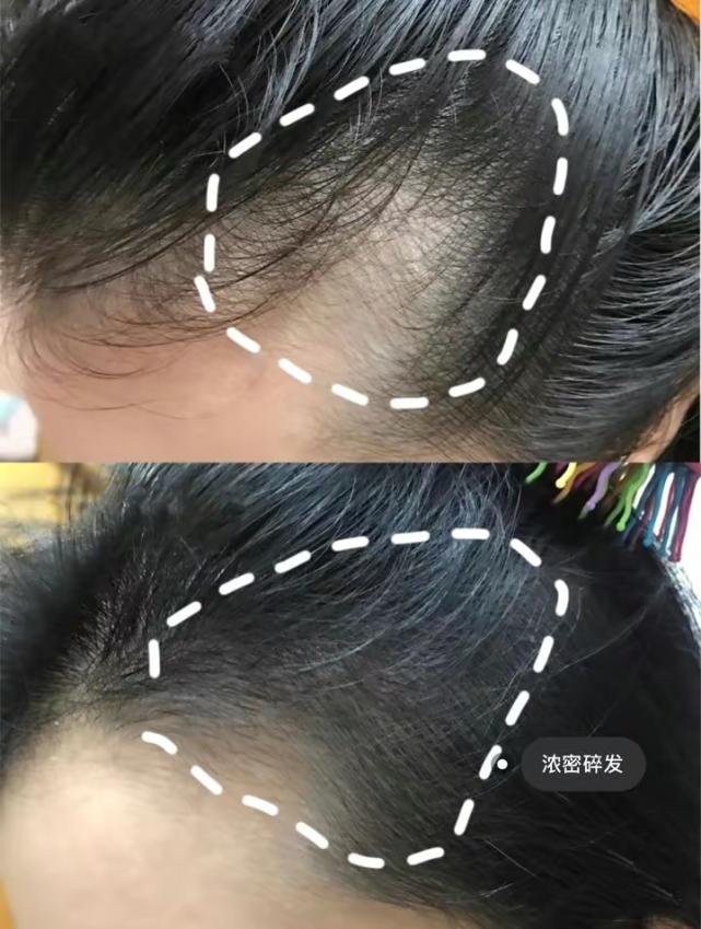 洗发水里防脱发,防脱生发蓬松洗发水平价推荐真实