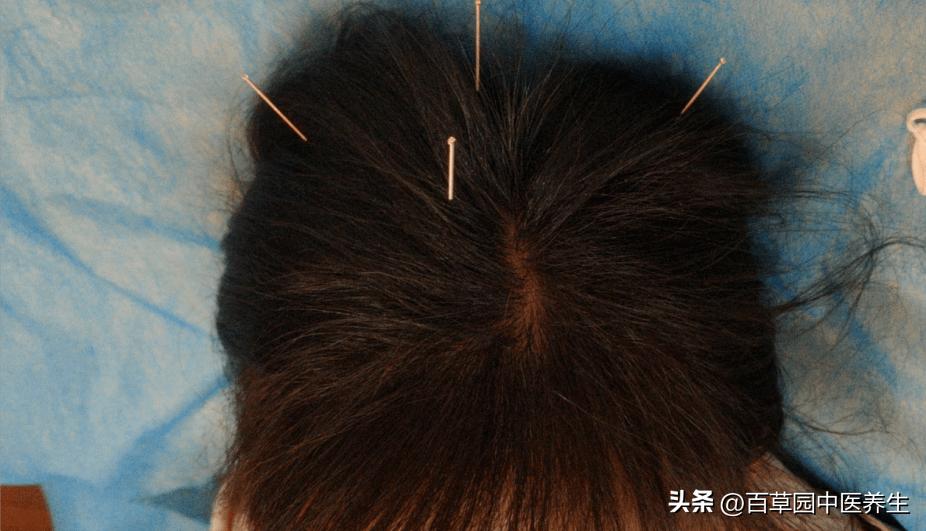 女童惊吓,4岁孩子受了惊吓去医院怎么治疗