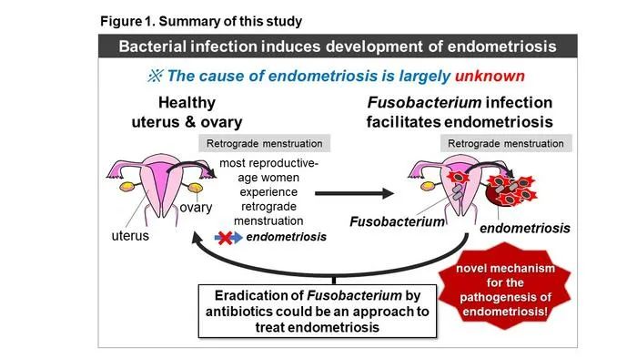 痛经疼痛难忍的危害,痛经很严重要警惕哪些病