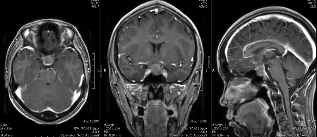 30岁就停经了是什么原因,30多岁就停经是甲状腺出问题了吗