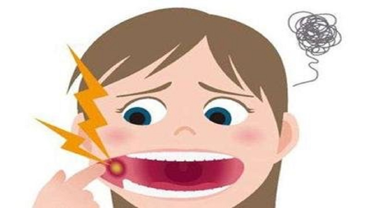 口腔溃疡维c和药物谁更有用,治疗口腔溃疡你只知道维c吗