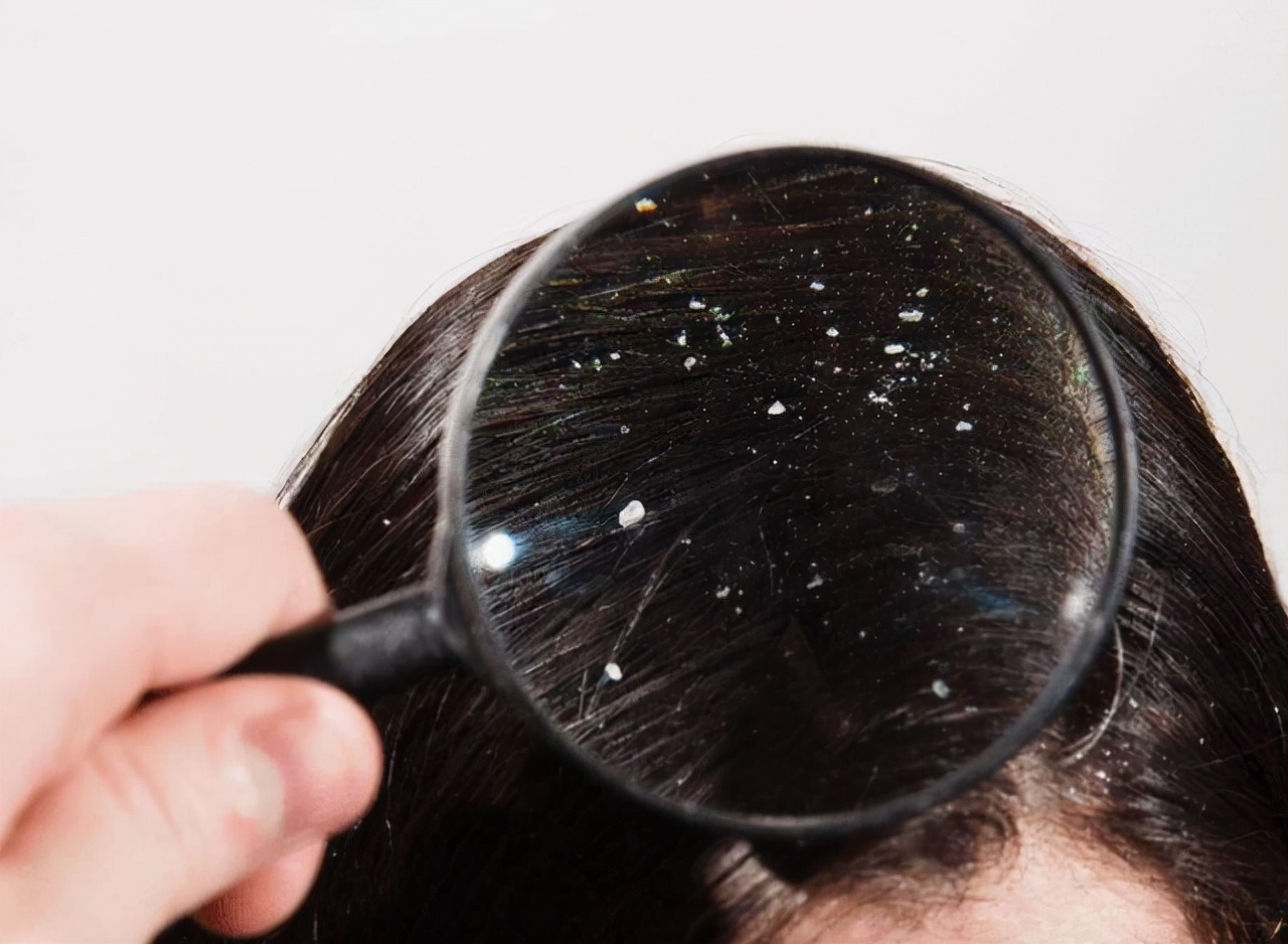 硫磺皂怎样洗头发,硫磺皂正确洗头发的方法