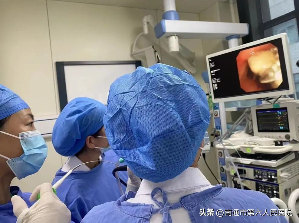 小镜子，大用途，一探究“镜”