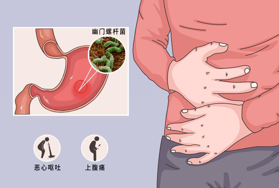 甲硝唑治什么最好,甲硝唑能摆平这四种病