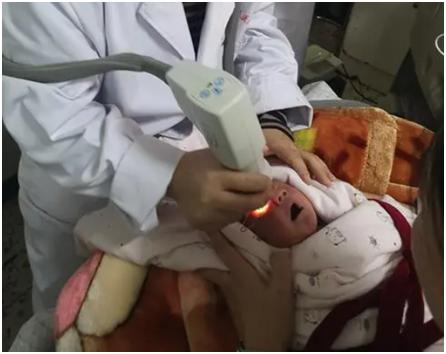 小胖威利综合征可以用基因修复吗,小胖威利是甲基化异常吗