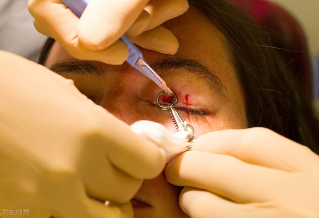 眼睑上长痘红肿,上眼睑长了小痘痘然后眼睛肿了