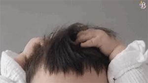 阳后要不要拍肺部CT？我用我的亲身经历告诉你，希望你永远用不上