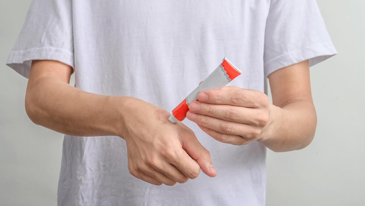 身上有一块白癜风头发也会变白吗,身上长了五处白癜风白斑严重吗