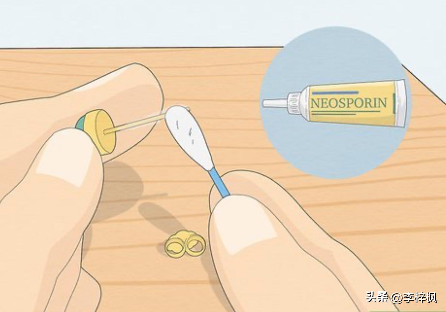 耳洞臭臭的怎么整啊,耳洞臭臭的是什么原因