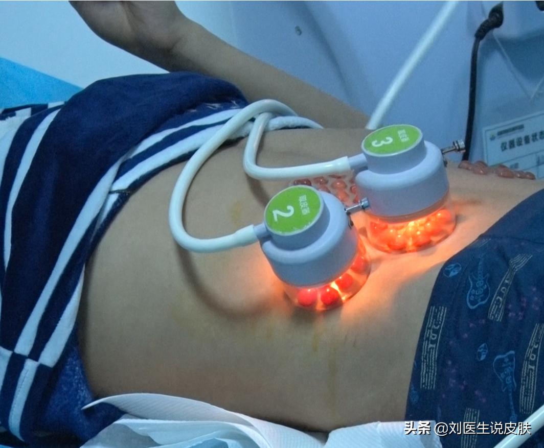 手部的白癜风怎样能治好,手部白癜风怎么治疗最好