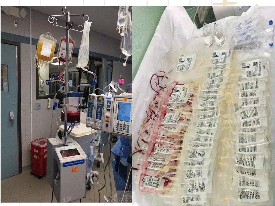 产科门诊给病人宣教课件,产科课件视频