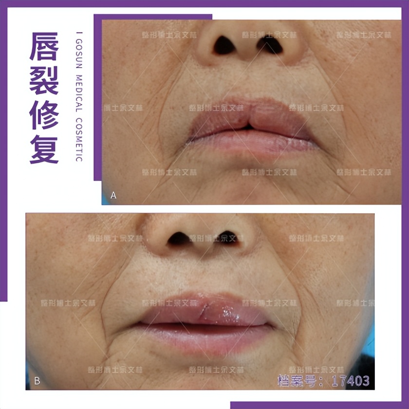 公认最好看的四种嘴唇,什么样的嘴唇最好看呢