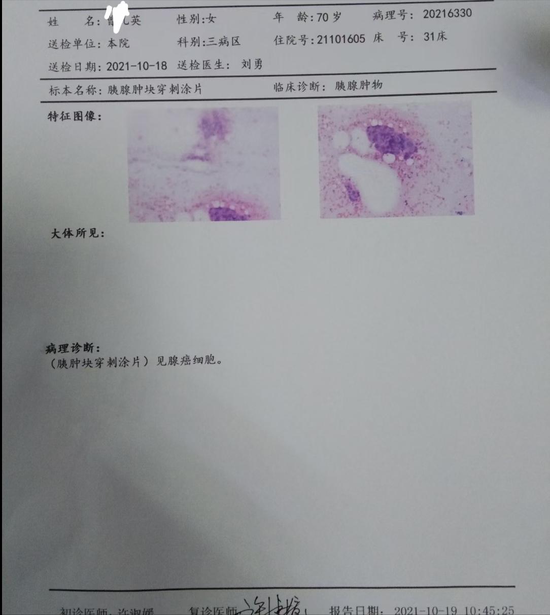 胰腺癌胰头占位继发低位胆道阻塞,27岁青年胰腺炎被误诊为胰腺癌
