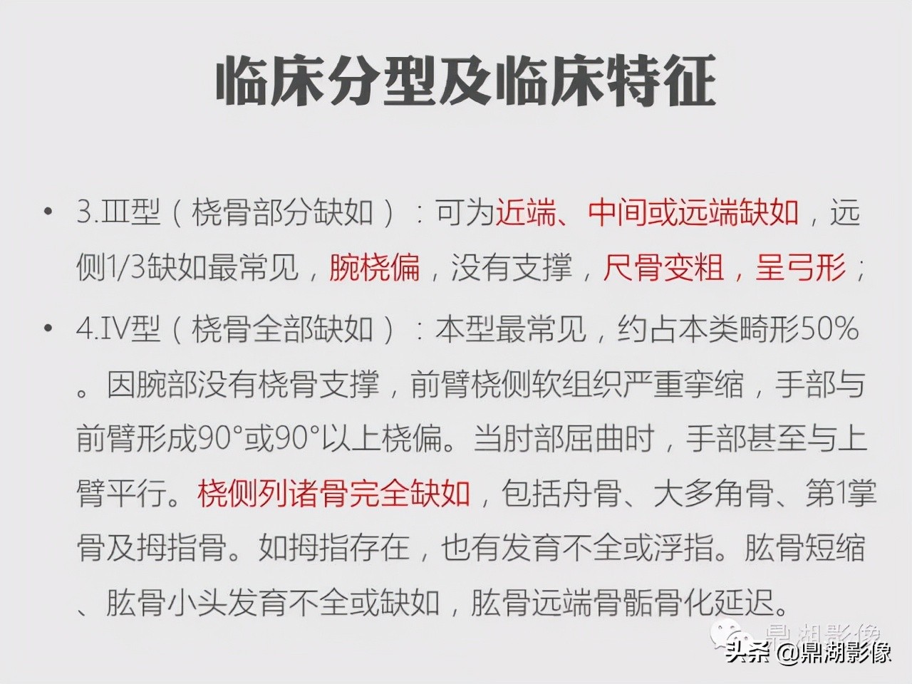 先天桡骨缺失畸形能治疗吗,先天性桡骨发育不良