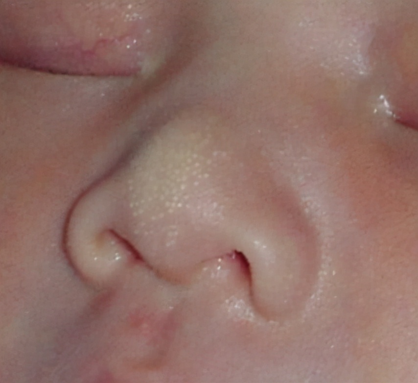 脸上长满白色点点，身上很多红色斑块，这么小，还来“姨妈”了？