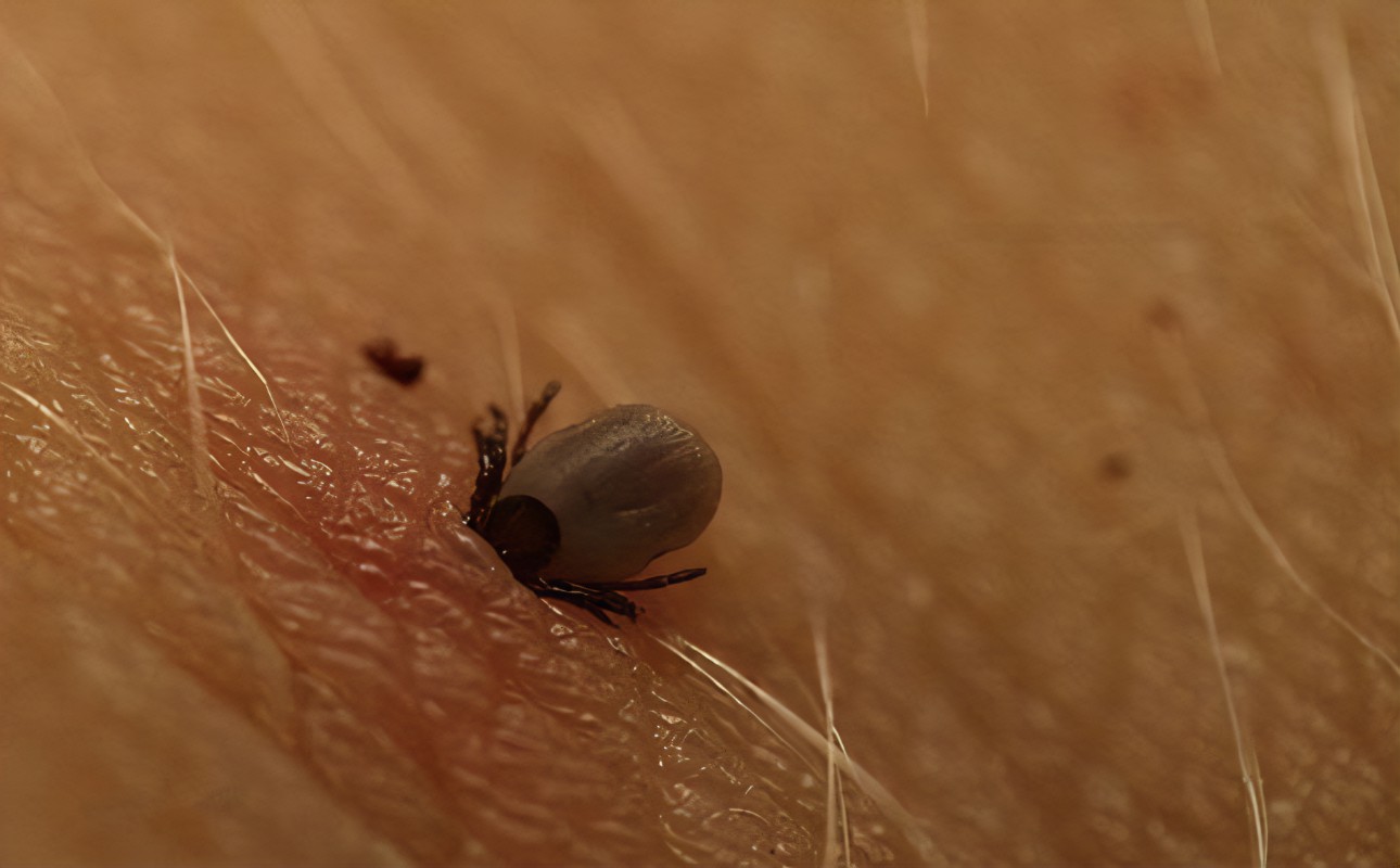 小孩被蜱虫咬了能活多久,孩子被蜱虫咬了三天