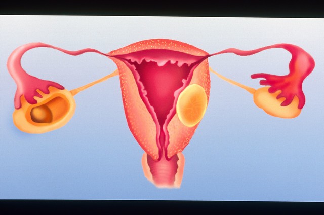 夫妻生活后，女性疼痛是伴侣的问题？4件事做好预防妇科病