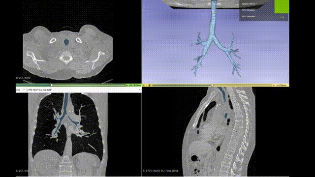 最小的仿生机器人,最小的微型机器人