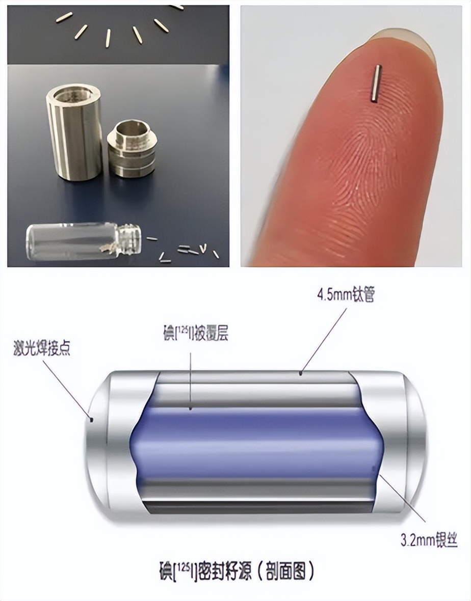 癌症放射性粒子植入对旁人的影响,放射性粒子植入对周围人的影响