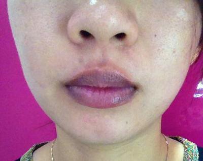 “羊亡爷”恩克:5个月内吃110只羊,从不吃青菜,面色乌青疵扩散