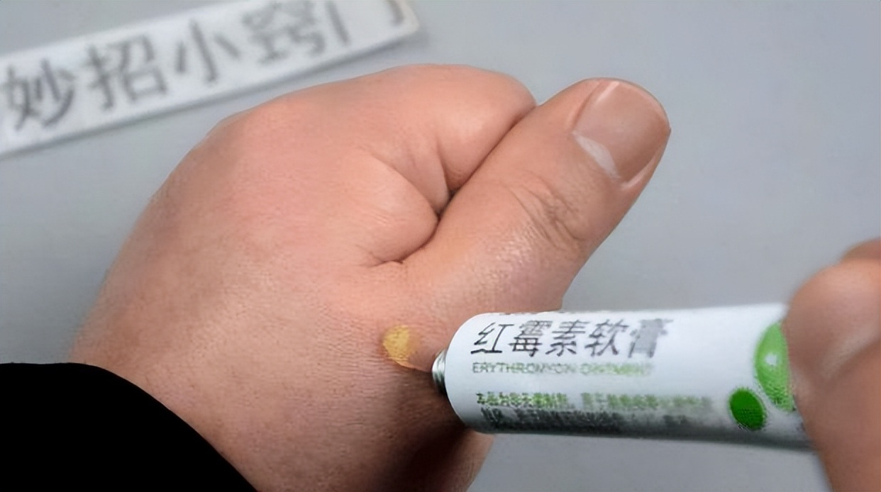 快速消除老年斑的小妙招红霉素,祛老年斑的最佳方法红霉素软膏