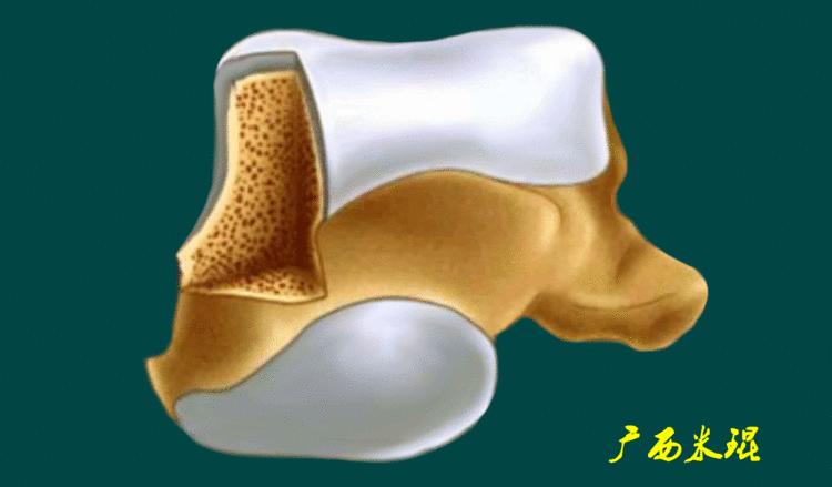 距骨软骨损伤最好的治疗方法,距骨软骨损伤的诊断