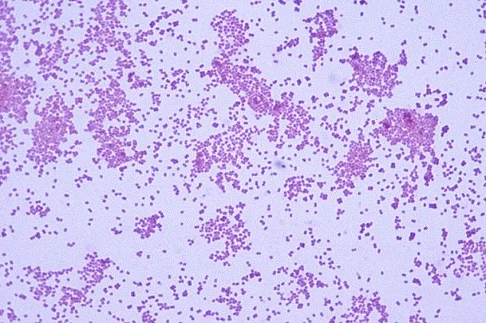 肠道核心微生物拟杆菌厚壁菌,人类肠道微生物定义