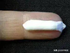 银屑病头皮怎么涂药,银屑病的涂药方法