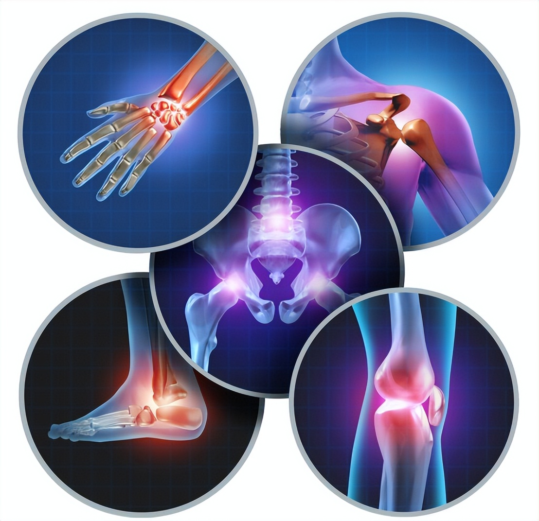 全球唯一可以治愈骨关节炎的药物,骨关节炎特效药最新研究