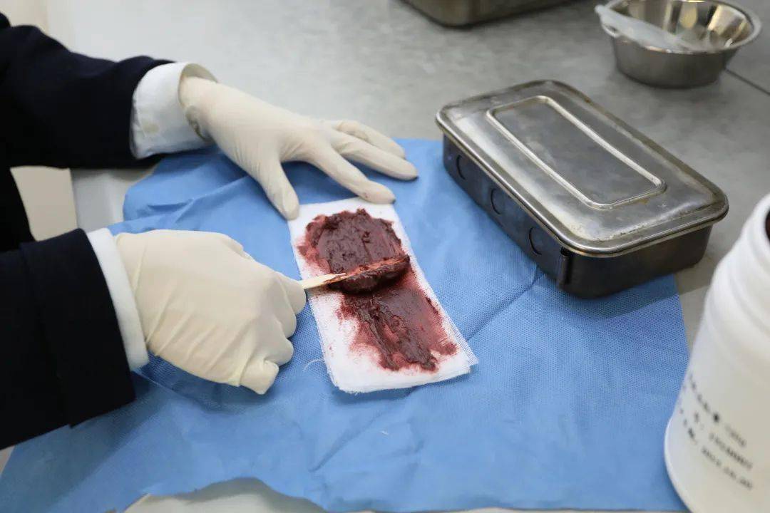 针刀治疗肛裂,有什么生肌药治疗肛裂