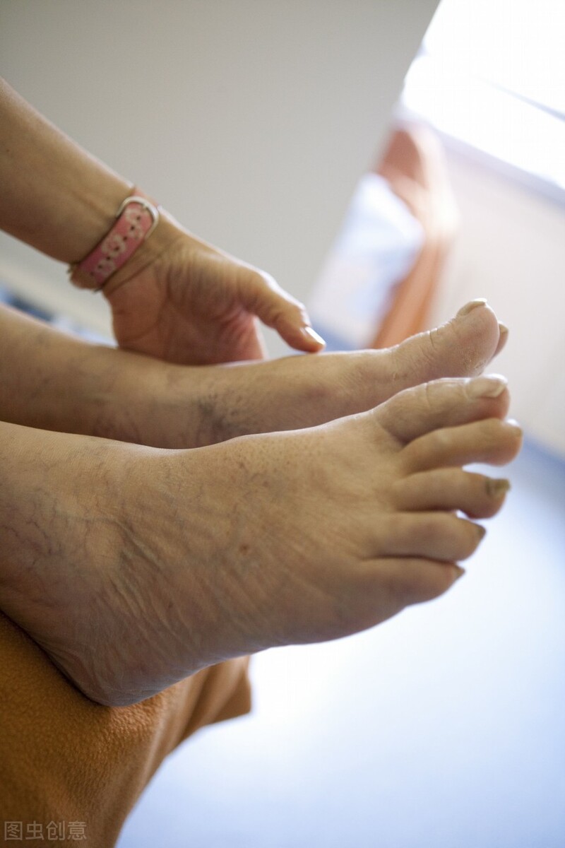 踝关节滑膜炎的症状,髋关节滑膜炎症状有哪些表现