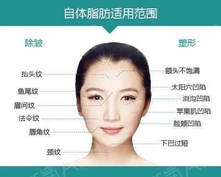 一句话帮你总结哪些医美项目,减龄的医美项目有哪些