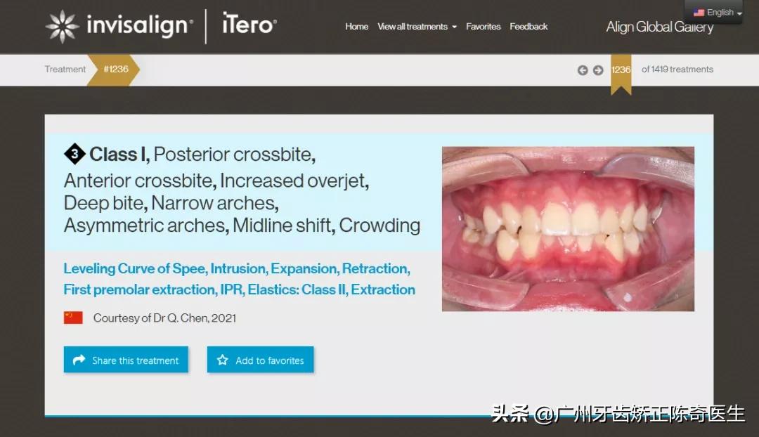 附着在牙齿上面硬硬的东西是什么,牙齿连接处有小疙瘩