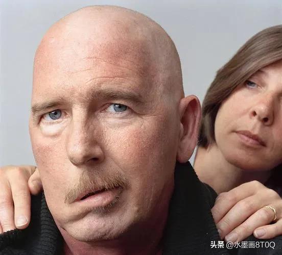 面瘫求医之路,面瘫患者求医