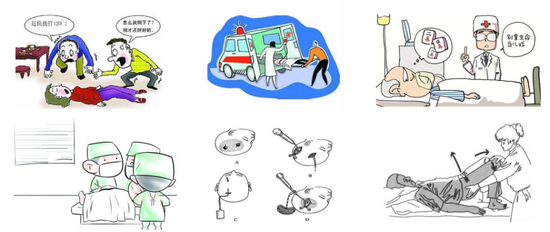 脑出血诊断后，如何处理？