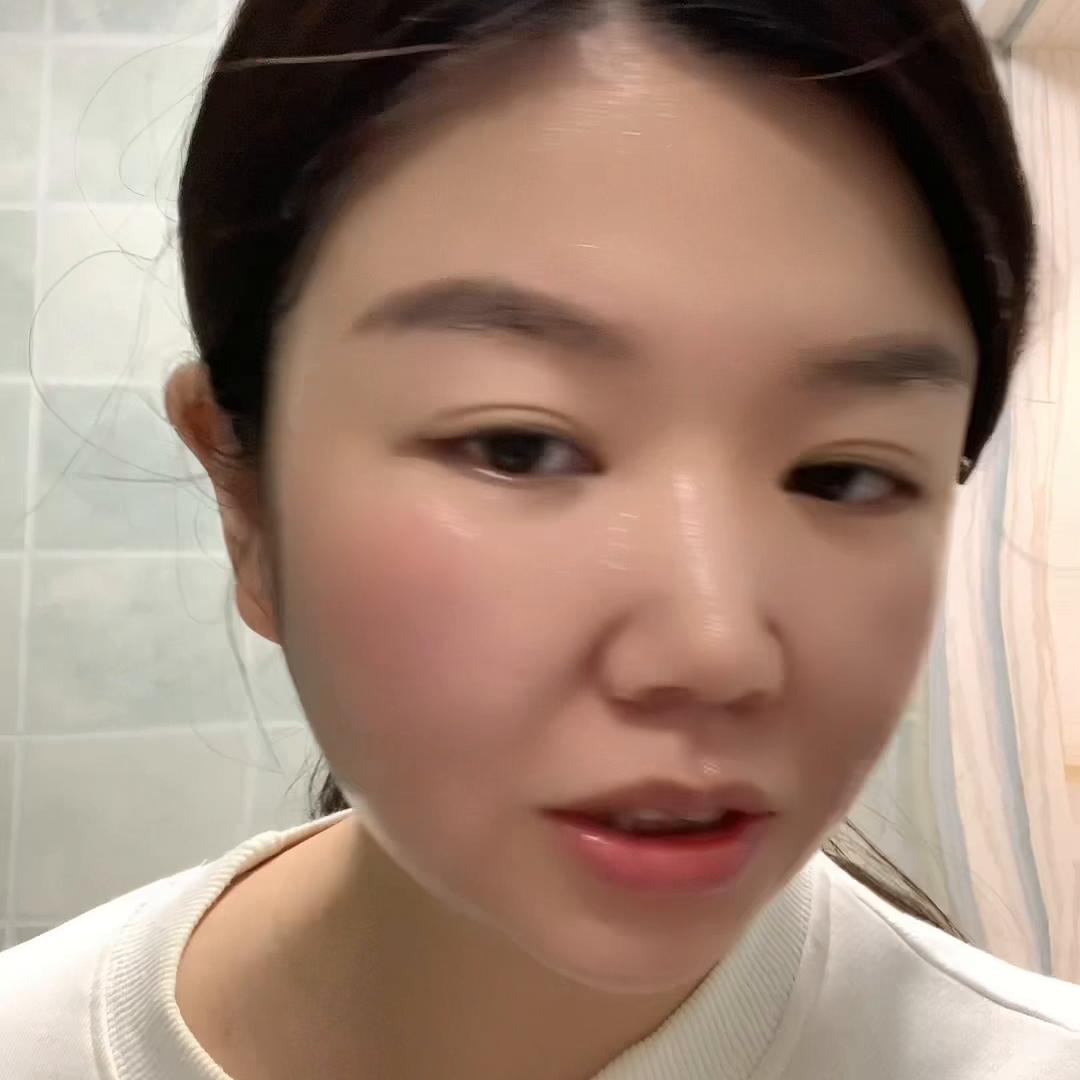 脸颊发热发红怎么最快消除,脸泛红发烫怎么快速改善呢