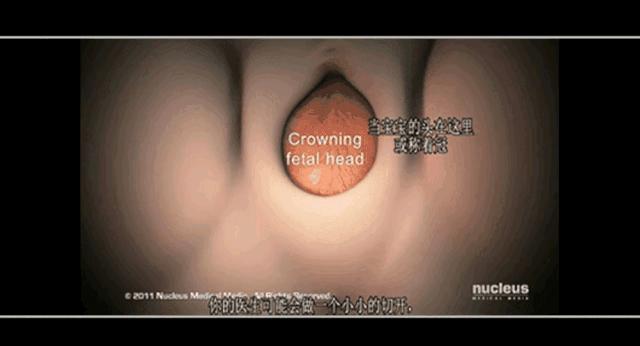 女人生孩子“开十指”全过程曝光，没人能笑着看完