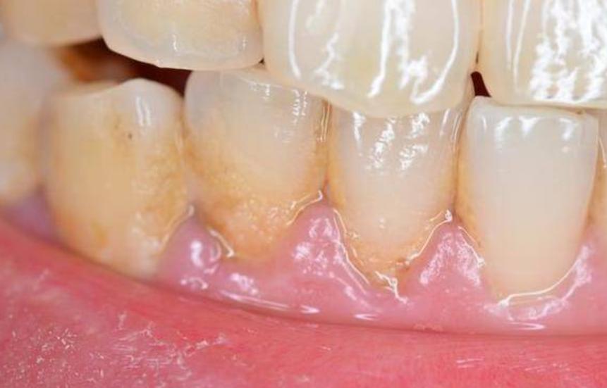 2020电动牙刷推荐排行榜,世界电动牙刷品牌排名前十名