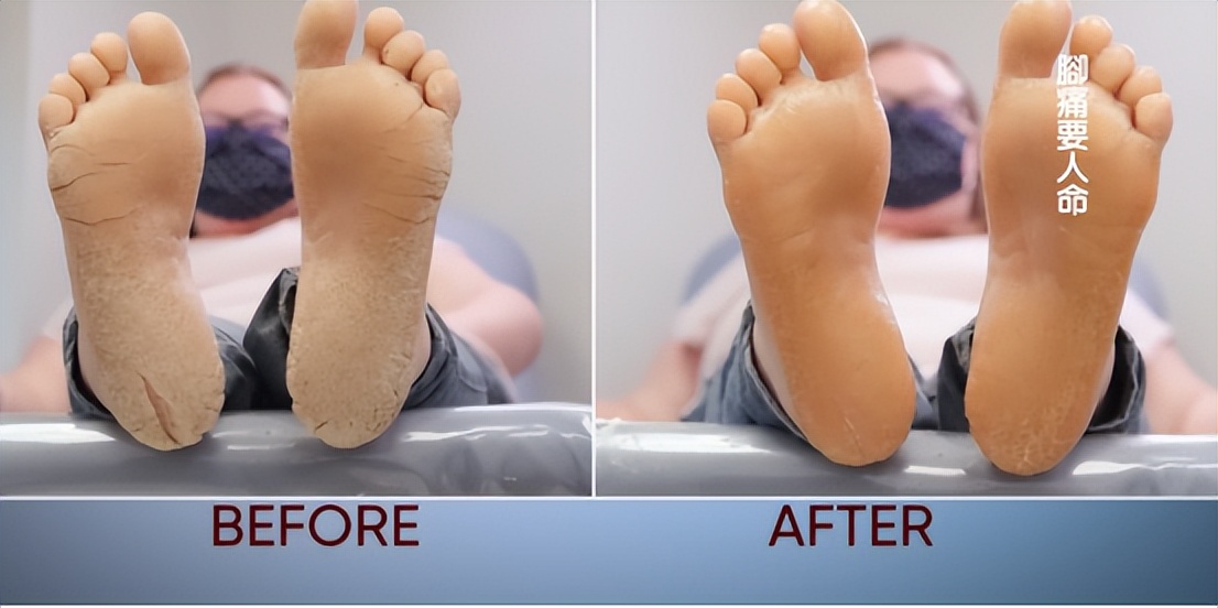 300斤美国女人,300斤胖女人美国