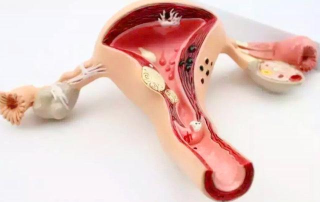 女人摘掉子宫还会来姨妈么,女人摘掉卵巢后与正常女人的区别