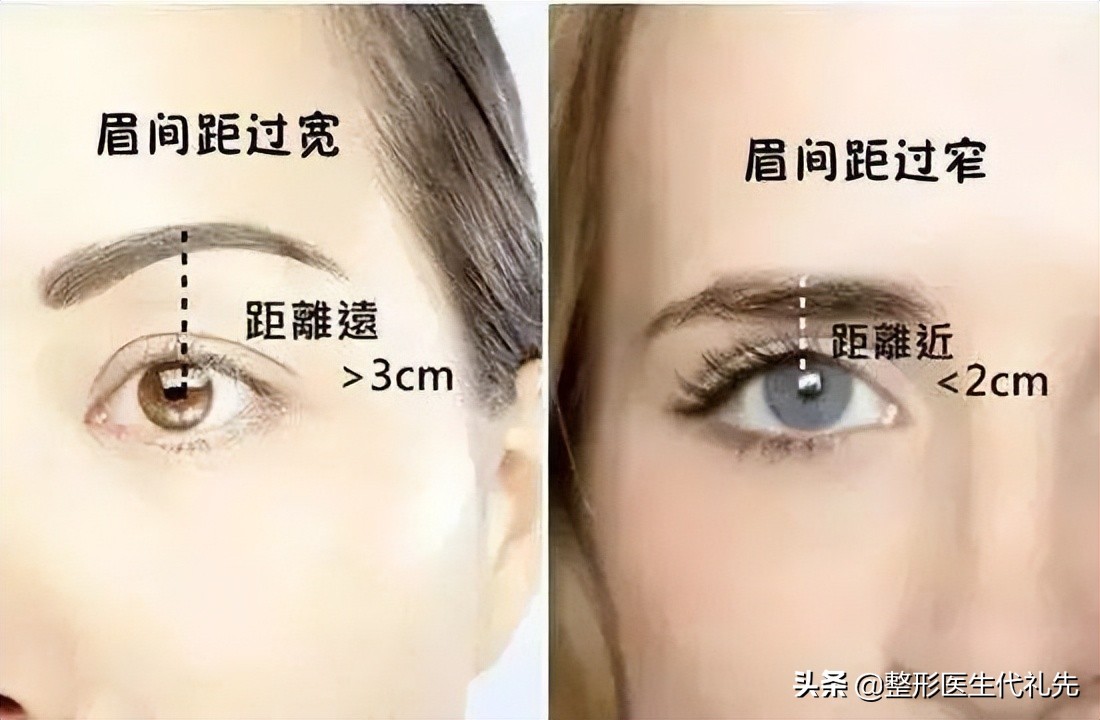 做提眉眼袋后需要用疤痕膏吗,提眉留疤痕了怎么办