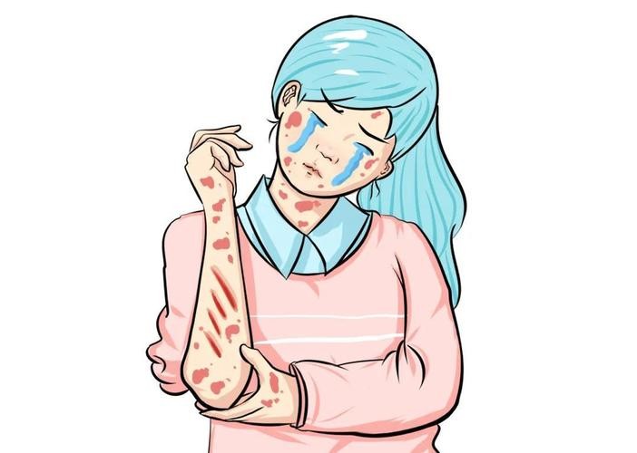 银屑病易与哪些皮肤病混淆,银屑病在人群中的比例