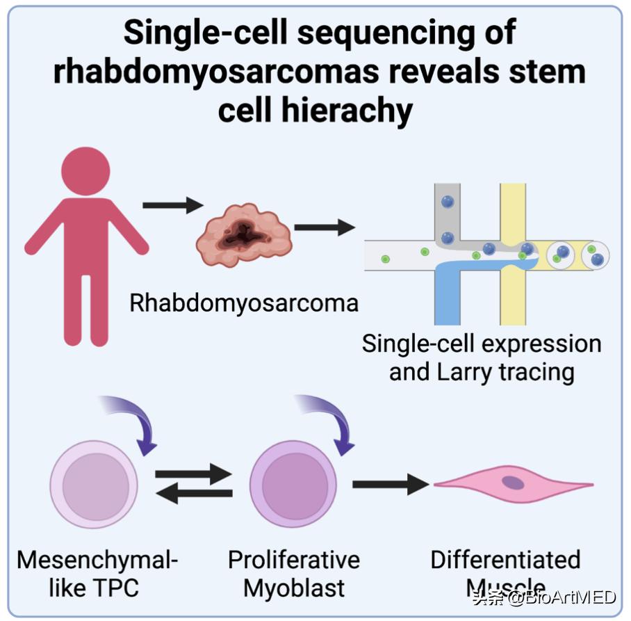 横纹肌肉瘤干细胞可以治吗,横纹肌肉瘤自体干细胞移植
